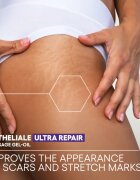 A-Derma Epitheliale A.H. Duo Massage Gel-Oil géles masszázsolaj hegekre és striákra 40 ml