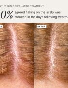 Alpha-H Healthy Scalp hámlasztó oldat fejre 100 ml