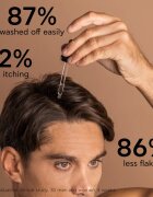 Apivita Dandruff Relief Oil a fejbőr ápolására zsíros korpa ellen 50 ml