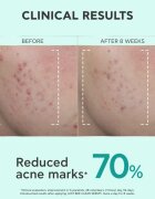 Apivita Just Bee Clear Serum szérum zsíros és problémás arcbőrre 30 ml