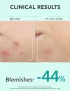 Apivita Just Bee Clear Serum szérum zsíros és problémás arcbőrre 30 ml