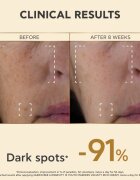 Apivita Queen Bee Longevity gazdag krém a ráncok ellen 50 ml