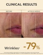 Apivita Queen Bee Longevity könnyű krém a feszes bőrért 50 ml