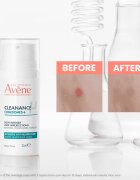 Avène Cleanance Comedomed+ intenzív ápolás a pattanásos bőr hibáira 30 ml