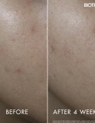 Biotherm Aquasource+ Vitamin Glow Gel arcgél 50 ml
