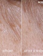 Biotherm Blue Peptides Eyes Lips Contour Reshaper bőrápoló a szem környékére és az ajkakra 15 ml