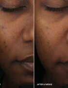 Bobbi Brown Vitamin Enriched Smoothing Serum bőrélénkítő szérum C-vitaminnal 30 ml
