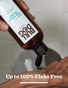 Bulldog Anti-Dandruff Shampoo korpásodás elleni sampon 300 ml
