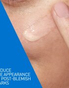 CeraVe Control Cleanser & Retinol Serum Duo komplex ápolás a pattanásos bőr hibáira