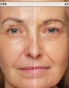 Chantecaille Just Skin Tinted Moisturizer tonizáló hidratáló kérm a ragyogó hatásért SPF 15 Glow 35 g