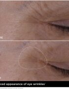 Clarins Double Serum Eye szemkörnyéki ráncok elleni szérum tápláló hatással 20 ml
