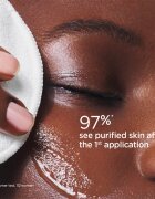 Clarins My Pure-Reset Purifying Matifying Toner tisztító és mattító tonik 200 ml