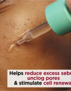 Clarins My Pure-Reset Resurfacing Blemish Serum regeneráló szérum az aknéra hajlamos zsíros bőrre 30 ml