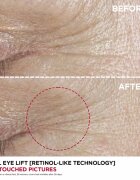 Clarins Total Eye Lift szemkrém a ráncok ellen 15 ml
