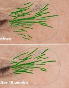 Clinique Smart Clinical™ Repair Wrinke Correcting Serum bőr szérum ránckorrekcióhoz 30 ml