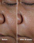 Clinique Smart Clinical™ Repair Wrinke Correcting Serum bőr szérum ránckorrekcióhoz 50 ml