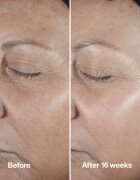 Clinique Smart Clinical™ Repair Wrinke Correcting Serum bőr szérum ránckorrekcióhoz 75 ml