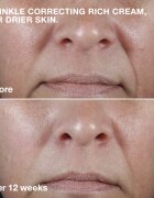 Clinique Smart Clinical™ Repair Wrinkle Correcting Cream Tápláló ránctalanító krém 50 ml