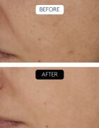 Cocunat Clinical Beauty Filler szett a bőröregedés ellen