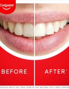 Colgate Max White Ultra Freshness Pearls fehérítő fogkrém 50 ml