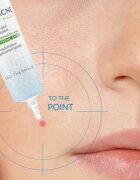 Dermedic Normacne Therapy helyi ápolás pattanások ellen 15 g