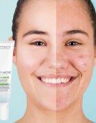 Dermedic Normacne Therapy hidratáló krém az aknés bőrre 40 ml