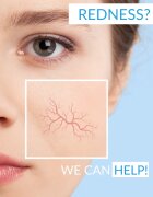 Dermedic Redness Calm nyugtató tisztító hab 150 ml