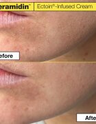 Dr. Jart+ Ceramidin™ Ectoin-Infused Cream hidratáló arckrém ceramidokkal 50 ml