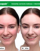 Dr. Jart+ Cicapair™ Soothing Color Correcting Treatment SPF 30 Intenzív ápolás a bőrpír ellen SPF 30 15 ml