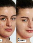 Dr. Jart+ Cicapair™ Tiger Grass Color Correcting Treatment Intenzív ápolás a bőrpír ellen 15 ml