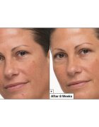 Dr. Jart+ Prejuvenation Cream with Bakuchiol regeneráló és feszesítő krém az öregedés jelei ellen 50 ml