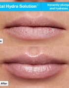 Dr. Jart+ Vital Hydra Solution™ Hydrating Lip Mask Jelly Bear Edition hidratáló maszk az ajkakra 20 ml