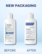 Ducray Kelual Squanorm Regulating Treatment Shampoo Oily Dandruff sampon zsíros korpa ellen 400 ml