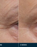 Elemis Pro-Collagen Future Restore Serum feszesítő szérum az élénk bőrért 30 ml