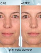 Elizabeth Arden Hyaluronic Acid + Peptides Ceramide bőrápoló kapszula szérum s ceramidy a peptidy 90 kapsz.