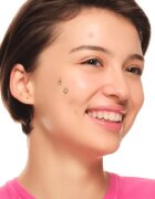 essence Spot Squad Pimple Patches tapasz problémás bőrre 32 db