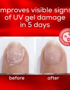 Essie to the rescue ápoló körömlakk sérült lábra 13.5 ml