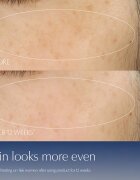 Estée Lauder Advanced Night Repair Serum Synchronized Multi-Recovery Complex ránctalanító szérum 50 ml