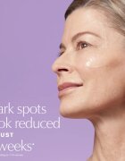 Estée Lauder Perfectionist Pro Rapid Brightening Treatment with Ferment³ + Vitamin C bőrélénkítő szérum C-vitaminnal a sötét foltok ellen 50 ml