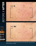 FILORGA DAILY PEEL ANTI-DARK SPOT arcpeeling a sötét foltok ellen 50 ml