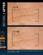 FILORGA DAILY PEEL ANTI-WRINKLE peeling a ráncok ellen 50 ml