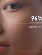 FILORGA SKIN PREP AHA CLEANSING GEL tisztító peelinges gél 150 ml