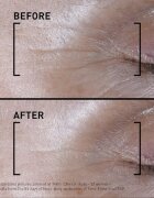 FILORGA TIME-FILLER SHOT intenzív szérum a bőröregedés első jeleinek eltüntetésére 15 ml