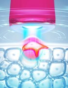 FOREO ESPADA™ 2 toll kék világítással a pattanások csökkentésére Fuchsia 1 db