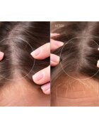 FOREO FAQ™ Scalp Recovery & Thick Hair Probiotic Serum probiotikus szérum a haj és a fejbőr regenerációjáért 60 ml