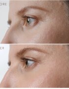 FOREO IRIS™ Firming Eye Serum fiatalító szérum szemkörnyékre 15 ml