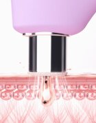FOREO KIWI™ Derma berendezés gyémánt mikrodermabrázióhoz és pórustisztításhoz 1 db