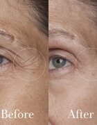 fresh Black Tea Age Renewal Eye Concentrate fiatalító szemkörnyékápoló krém 15 ml