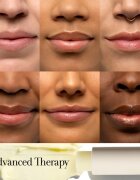 fresh Sugar Advanced Therapy Treatment Lip Balm hidratáló ajakbalzsam 43 g