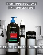 Garnier Pure Active gyengéd géles krém a bőrhibákra 50 ml